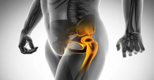 Kalça Sıkışması Sendromu Ameliyatı