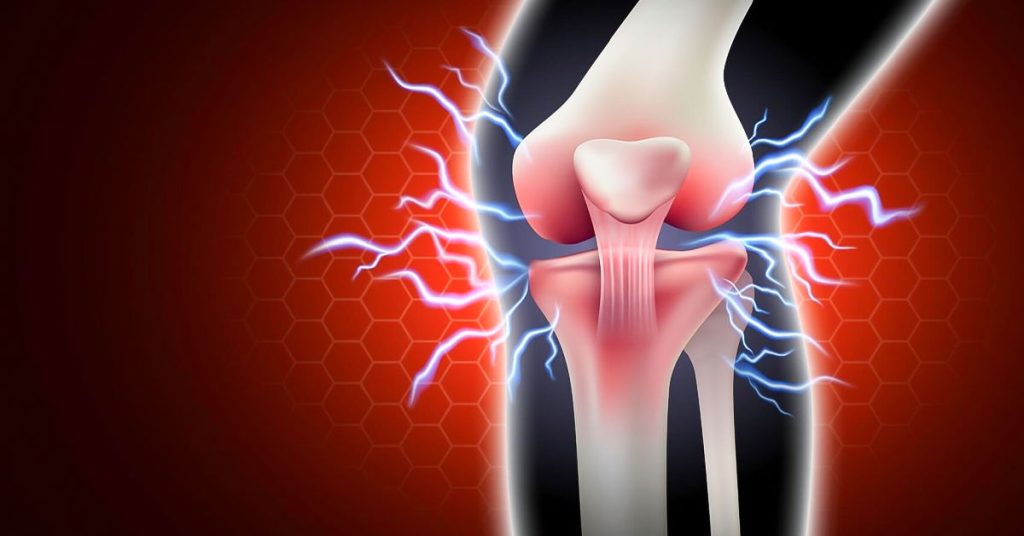 Ön Çapraz Bağ Yırtığı Tedavisi