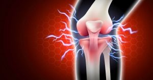 Ön Çapraz Bağ Yırtığı Tedavisi