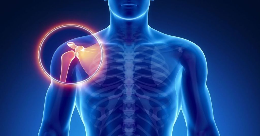 Omuz Çıkığı Ameliyatı