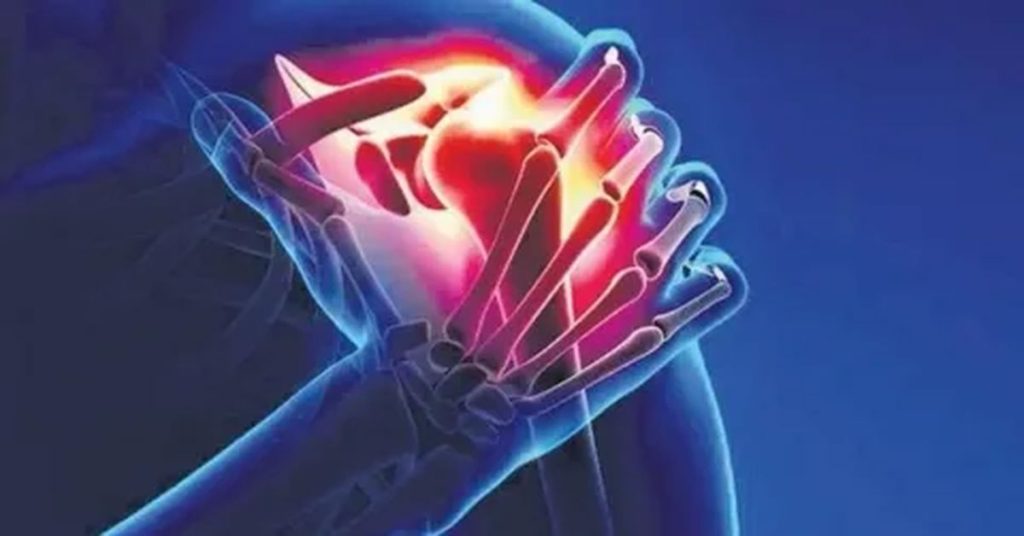 Omuz Çıkığı Tedavisi