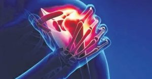 Omuz Çıkığı Tedavisi