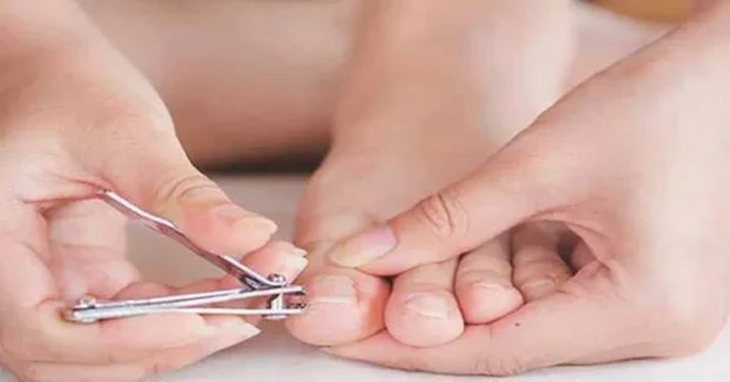 Tırnak Batması Ameliyatı